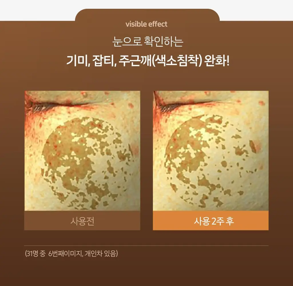 [잡티톤업]더페이스샵 올티밋 비타민 고함량 멀티 비타 10% 세럼 30ml 상세페이지 8
